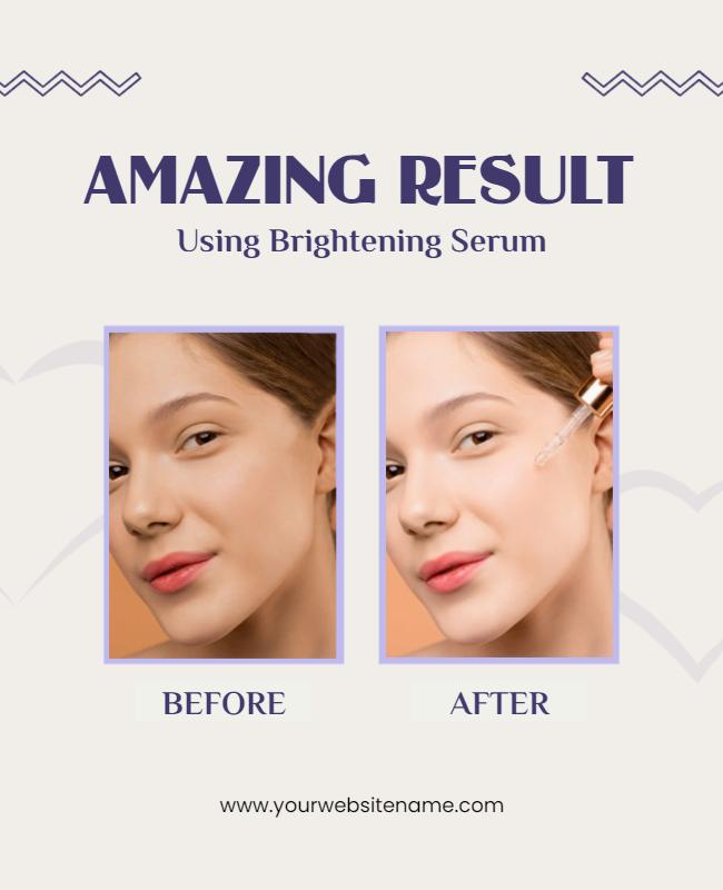 Brightening Serum Skincare Results Flyer Template