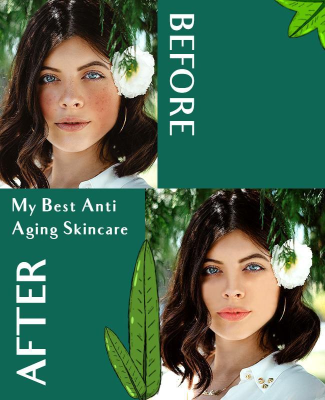 Elegant Green Skincare Before and After Transformation Poster Template