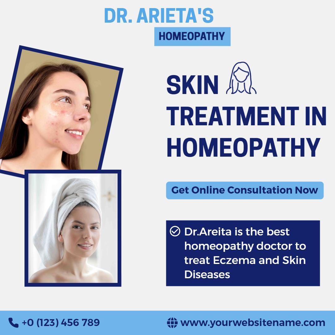 Homeopathic Skin Treatment Consultation for Eczema and Skin Diseases Ad Template