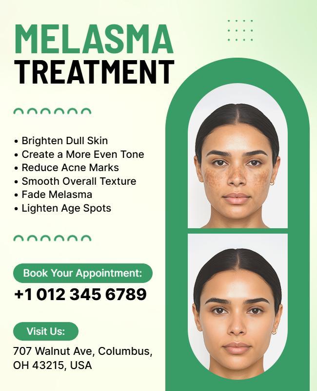 Melasma Skin Treatment Promotional Flyer Template