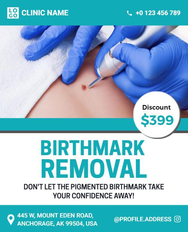 Professional Blue Birthmark Removal Treatment Poster Template