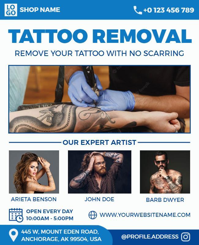 Professional Tattoo Removal Service Flyer Template