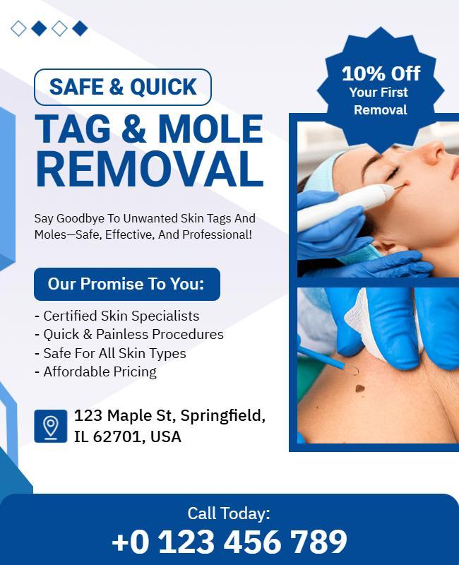 Skin Tag and Mole Removal Service Flyer Template