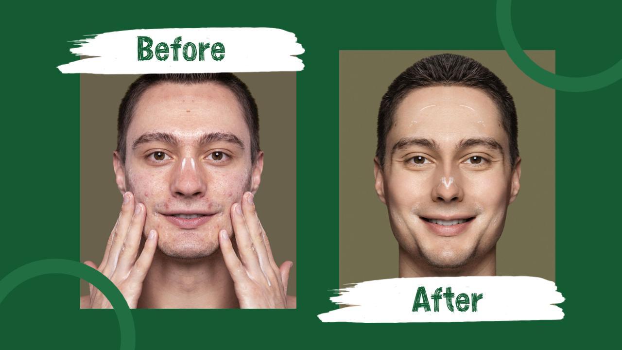 Skincare Transformation Journey Trending YouTube Thumbnail Template