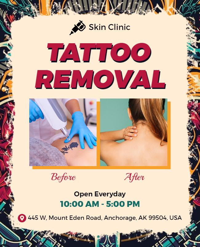 Tattoo Removal Service Promotional Flyer Template