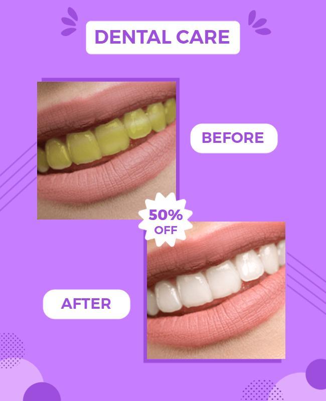 Vibrant Purple Dental Care Before and After Discount Poster Template