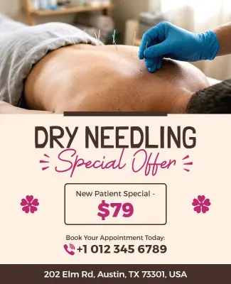 Dry Needling Special Offer Flyer Template