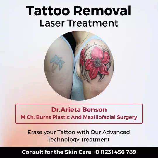 Effective Tattoo Removal Laser Treatment Consultation Ad Template