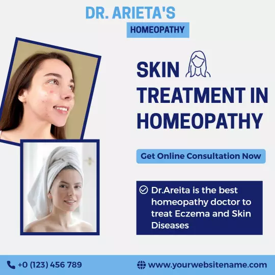 Homeopathic Skin Treatment Consultation for Eczema and Skin Diseases Ad Template