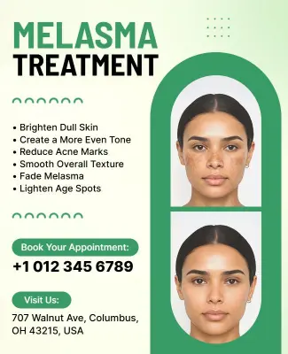 Melasma Skin Treatment Promotional Flyer Template