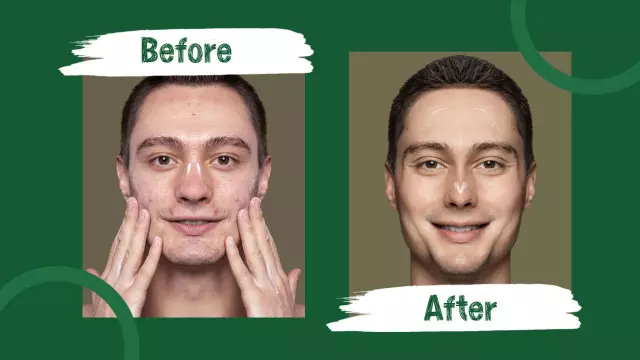 Skincare Transformation Journey Trending YouTube Thumbnail Template